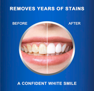 Purezza Teeth Whitening Strips